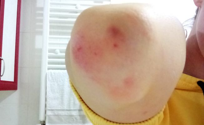 SOKAK KÖPEKLERİ KIZ ÇOCUĞUNA SALDIRDI